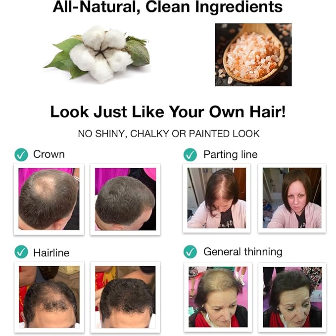 Quick Fix For Thinning Hair and Bald Spot. Get 10X Fuller Hair Instantly. All-Natural Hair Building Fiber For Hair. Trial Size (10-Day Supply). Light Brown