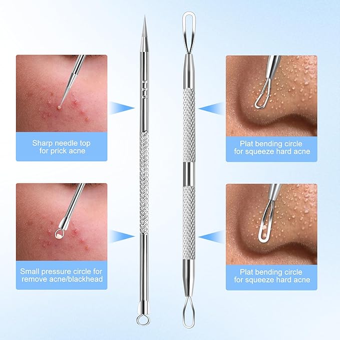 Blackhead Remover Tweezers, Pimple Popper Tool Kit, Ingrown Hair Tweezers, Blackhead Extractor, Skin Zit Acne Blemish Popping Removing Surgical Tweezers Tools for Nose Eye Face