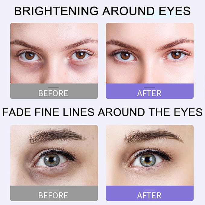 Under eye roller cream for