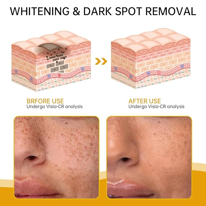 Bee Venom Wrinkle Firming Cream Multi – Anti-Aging, Moisturizing & Lifting Skin Treatment Purpose Cream for Wrinkle Removal & Firmness