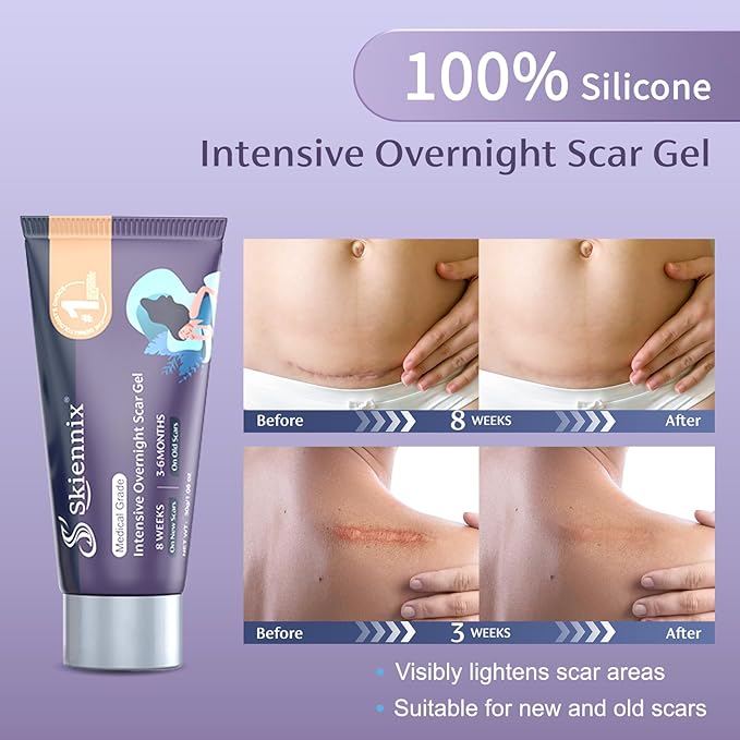 PM Intensive Overnight Scar Cream 1.06