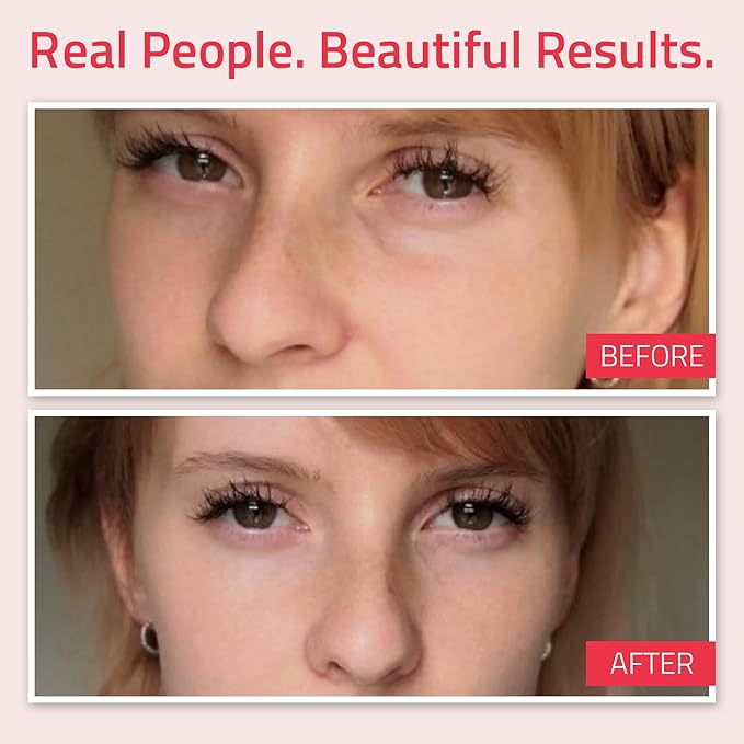 YEOUTH Retinol Eye Cream with Hyaluronic Acid, Hydrating Under Eye Cream for a Refreshed Appearance, Retinol Cream for Face, Eye Care 1oz