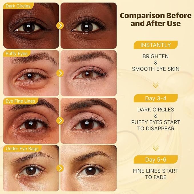 Under Eye Patches for Puffy Eyes and Dark Circles (20 Pairs), Under Eye Gold Mask with Hyaluronic Acid & Collagen to Reduce Wrinkles and Relieve Pressure, Eye Care Treatment for Men & Women Gift