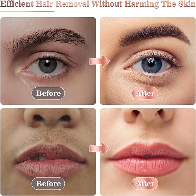 Facial Hair Remover for Women, Face Hair Trimmer, Rechargeable Women's Facial Shaver, Painless Lady Shavers for Women for Face Hair, Upper Lips, Peach Fuzz, Bikini Body-White