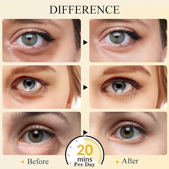 Under Eye Patches(15 Pairs), 24K Gold Eye Mask for Dark Circles, Puffy Eyes and Wrinkles, with Hyaluronic Acid & Collagen