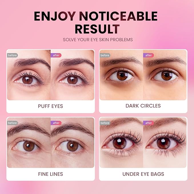 Under eye patches (24 pairs)-new