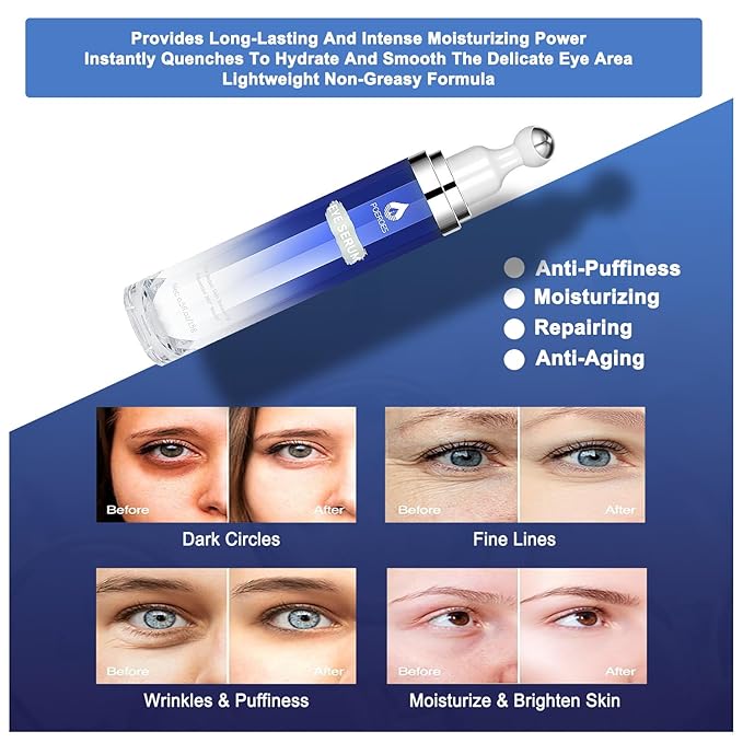 eye serum for dark circles and puffiness - 8% Caffeine, 8% Retinol - Dark Circle Remover, Puffy Eyes & Bags - Under Eye Cream, 1.5 fl. oz