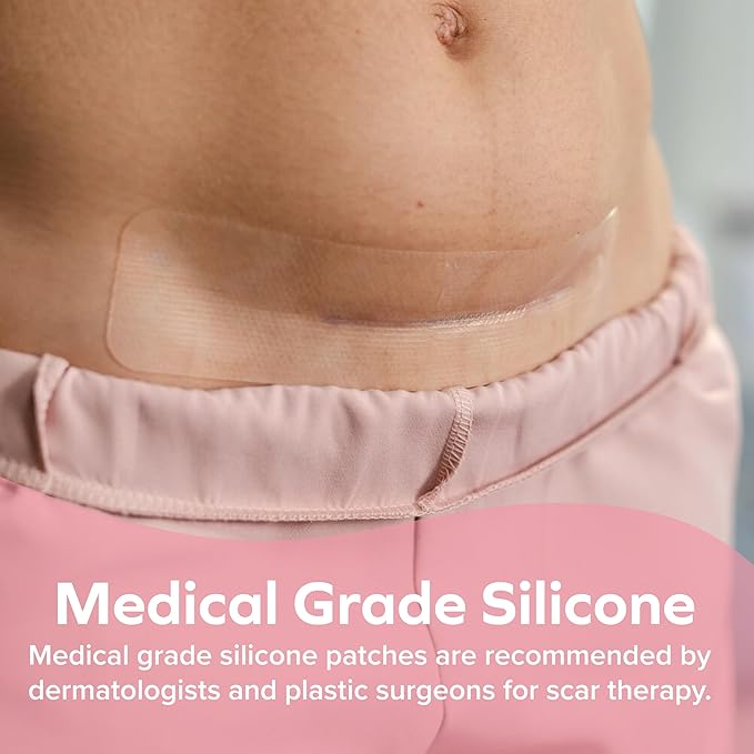 Dr. Talbot's Mom Stretch Mark & C-Section Scar Strips - Medical Grade Silicone Scar Strips to Soften and Flatten Surgical Scars - 6 Count (60-Day Supply)