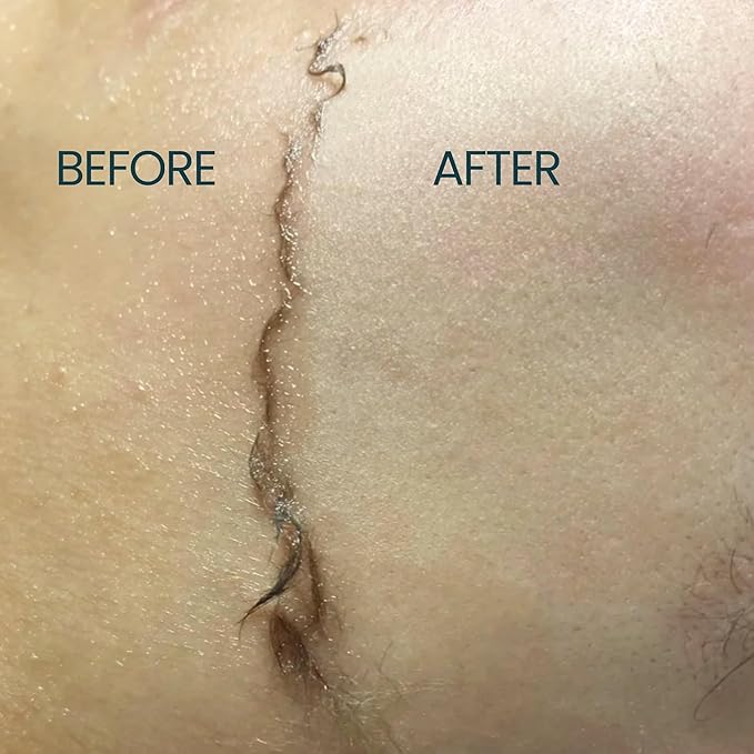 Dermaplane Oil for Women with Dry Skin - Face Shaving Oil - Non Comedogenic, Fragrance Free, Natural & Lightweight - Use with Dermaplane Razor for Women Face, 2oz by Ouiloe