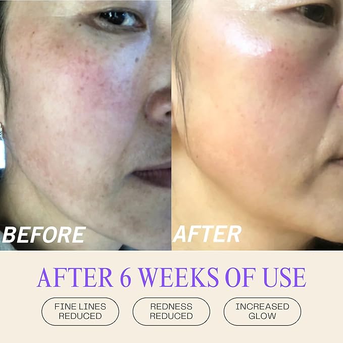 Mudita Earth Squalane Anti Aging Skin Cream, Rich Moisturizer for Aging & Dry Skin, Hyaluronic Acid, Squalane for Dark Spots & Hyperpigmentation made with Pomegranate & Olive