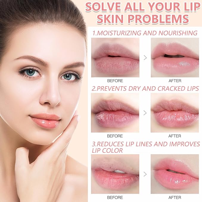 3PCS Bee Lip Balm Honey Pot,Honey (Honey+Strawberry+Watermelon)