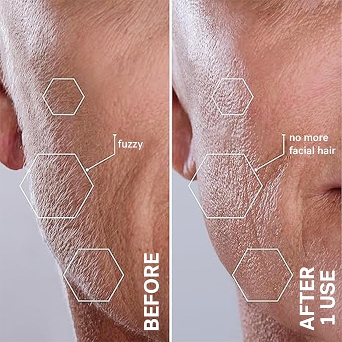 Michael Todd Beauty Sonicsmooth Pro+ Dermaplane Razor for Women Face + Eyebrow trimmer Dermaplaning System w/LED Light Peach Fuzz Remover -16 Dermaplaning Blades & 2 Microsmooth Exfoliation Tips