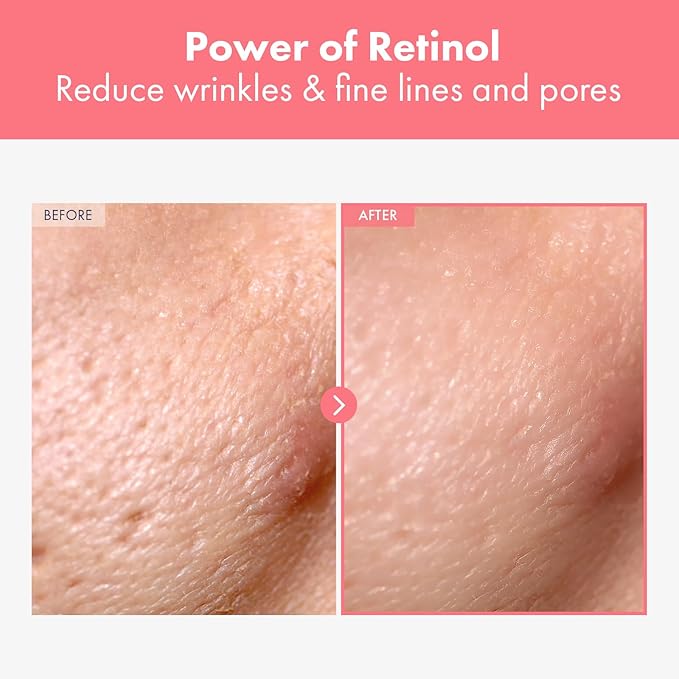 Repair Retinol Cream, Liposomal Retinol