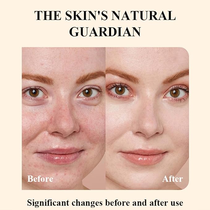 Whipped Beef Tallow and Honey Balm, Grass Fed Grass Finished Face Cream for All Skin Types - Grass-Fed Beef Tallow & Raw Wild Honey Blend - All-Natural Moisturizer for Face & Body, 2 OZ