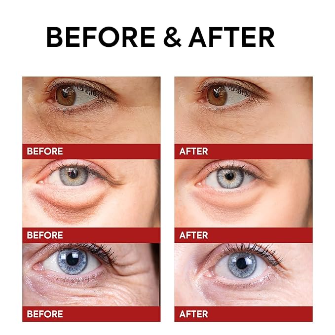 Rapid Reduction Retinol Eye Cream: Under Eye Cream Instantly Reduces Wrinkles Fine Lines Under Eye Bags Puffiness Dark Circles Crow's Feet - Rapid Face Lifting Tightening Firming 1 OZ/15g