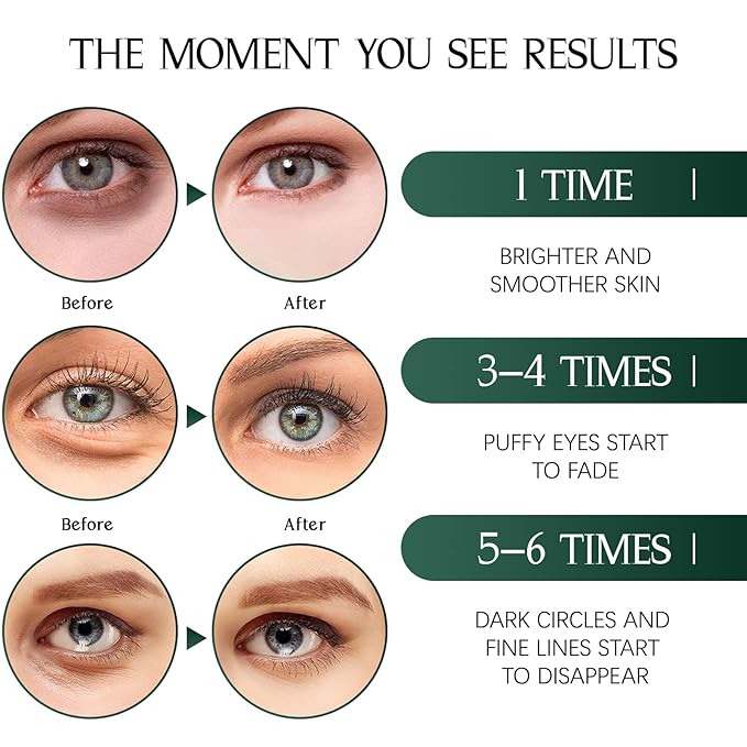 Tiepetly under eye masks, collagen