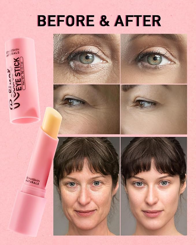 Under Eye Stick For Puffiness: Retinol Under Eye Treatment Reducing Eye Bags and Dark Circles - Eye Balm for Fine Lines, Wrinkles and Puffiness, Eye Cream for Late Nights,