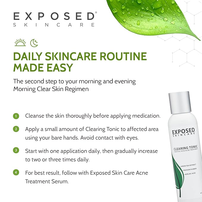 Exposed Skin Care Clearing Tonic Facial Toner with 1% Salicylic Acid and Witch Hazel for Acne Treatment – Pore Minimizing Toner to Prevent Breakouts, Reduce Redness and Balance Skin – Step 2 (4 fl oz)