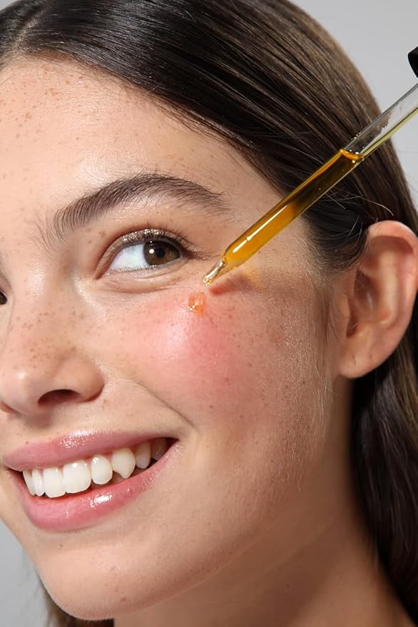 Cliganic Organic Rosehip Seed Oil for Face, 100% Pure | Natural Cold Pressed Unrefined Non-GMO | Carrier Oil for Skin, Hair & Nails (Packaging May Vary)