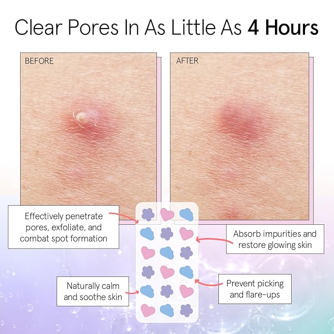 grace & stella Award Winning Pore Strip - Pimple Patches for Face - Hydrocolloid Acne Patches - Absorbs Zits, Reduces Redness - Cute Patches Dermatologist-Tested, Vegan (Multishape, 72 Count)