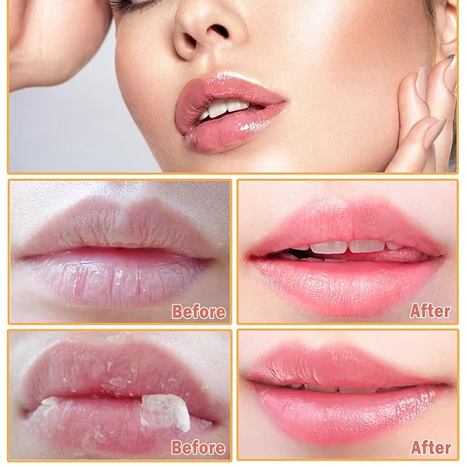 2Pcs Honey Pot Bee Lip Balm