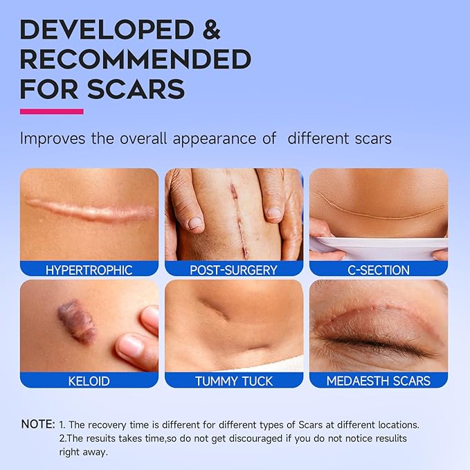 Thicker Silicone Scar Sheets, Medical Grade