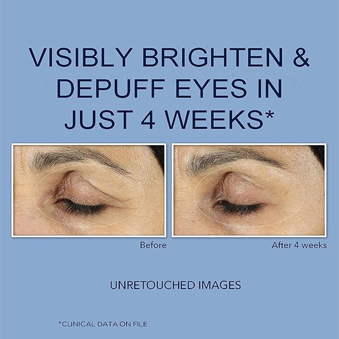 Retinol Polypeptide Eye Cream,Retinol Eye Cream for Dark Circles and Puffiness, Visible Results in 3-4 Weeks, Under Eye Cream for Anti Aging, for Puffiness and Bags to Reduce Fine Lines(2pcs)