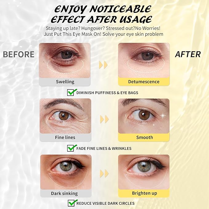 Under Eye Patches(30 Pairs), 24K Gold, Caffeine, Hyaluronic Acid, Aloe Vera Eye Masks for Dark Circles Puffy Eyes Undereye Bags, Eye Skin Care Gift Set for Bachelorette Party Favors