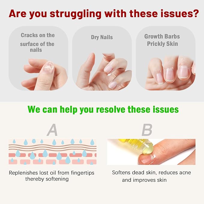 Cuticle Oil - Cuticle Oil