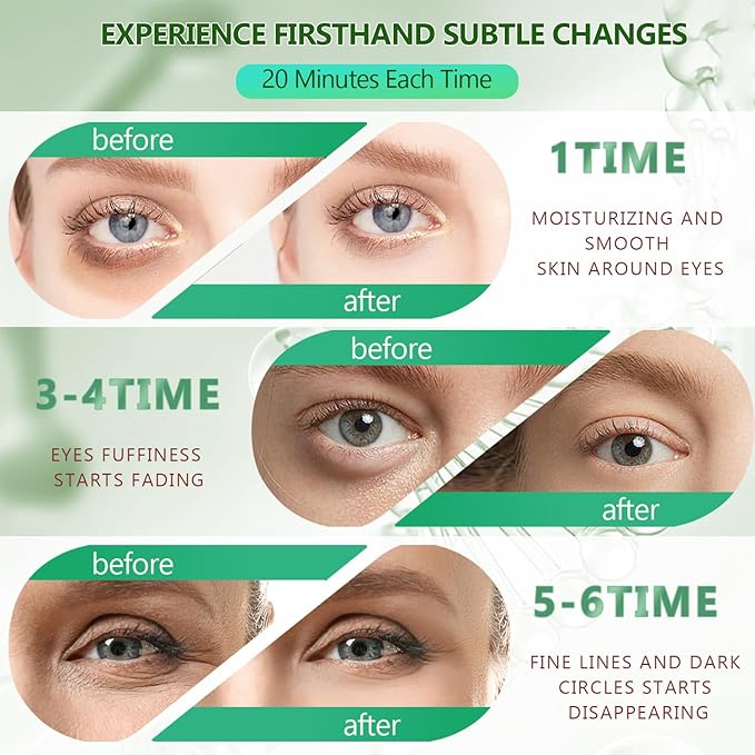 3 Packs 60 Pcs Under Eye Patches, Green+24K Gold+Pink, 30 Pairs Undereye Mask for Puffy Eye Dark Circle Treatment, Collagen Gel Pads Hydrating for Eye Bag Puffiness Wrinkle, Women Men Beauty Skin Care