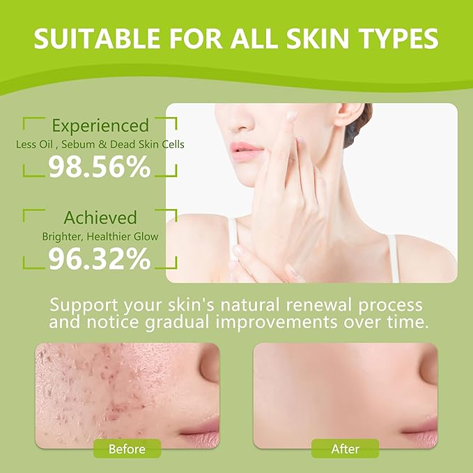 30pads turmeric kojic acid cleansing