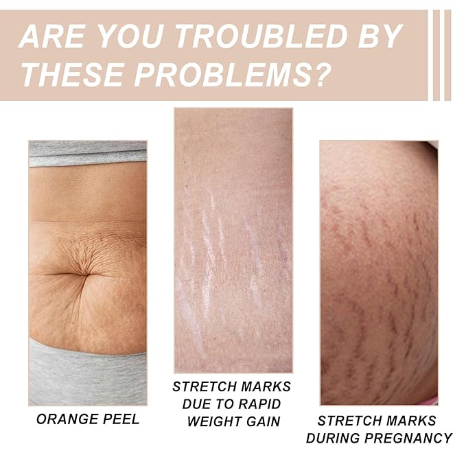 Butter Drench Restorative Rich Face Cream, Reduces Pregnancy Repair Skin, Hydrating Face Lotion, Helps Skin Retain Moisture, Soothes Dry Skin