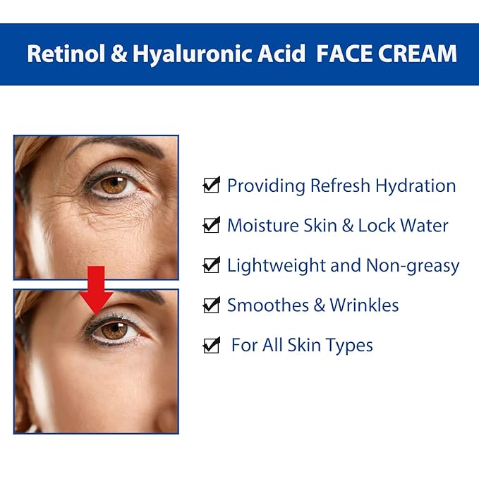 Moisturing Face Cream Skincare for Women,Day Night Retinol Hyaluronic Acid Facial Cream for Face,Hydration Face Cream for All Skin Types (1.7 Oz)
