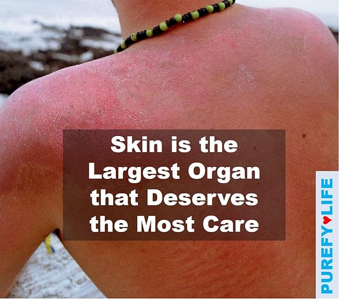 Topical Airesol Spray (3.4oz, 2pk) Soothing Face & Body Skin Spray, Purefypro Dermal HOCL Technology, Natural Skincare Support Redness, Irritations, Eyelid Bumps, Dry Skin, Athletic Itch