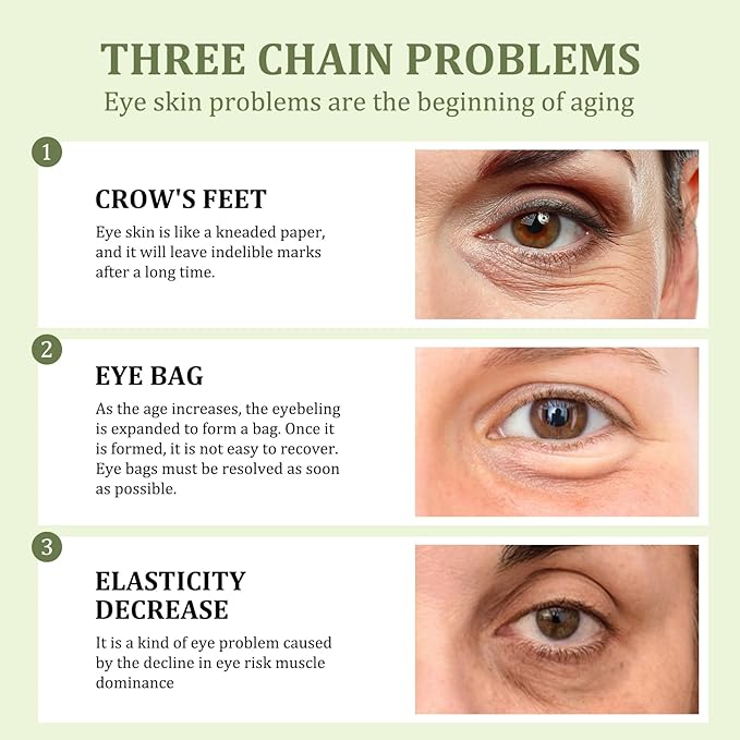 Retinol Eye Cream Brightening Eye Stick Anti-aging Eye Cream for Dark Circles and Puffiness Dark Circles Under Eye Treatment Under Eye Cream Puffy Eyes Treatment Firm Eye Bags Treatment for Men Women