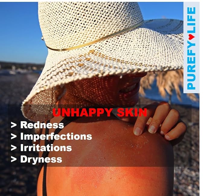 Topical Airesol Spray (3.4oz, 2pk) Soothing Face & Body Skin Spray, Purefypro Dermal HOCL Technology, Natural Skincare Support Redness, Irritations, Eyelid Bumps, Dry Skin, Athletic Itch