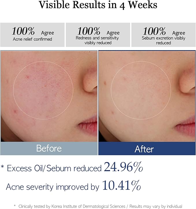 Re.SPN PHA Succinic Acid Calming Toner Pads – Daily Exfoliating, Hydrating and Soothing with CICA, Caffeine, Non-comedogenic, Vegan, Glass Skin, K-Beauty (70 Count)