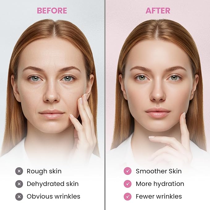 New Anti Facial Wrinkle Patches: Anti Wrinkle Patches Overnight - Smile Line Pathces - Facial Wrinkle Patche for Forehead, Smile Line, Under Eye 144 Pcs (1 Count (Pack of 144), Unscented)