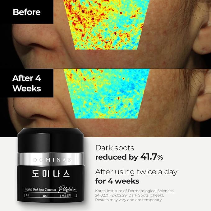 DOMINAS Dark Spot Corrector Cream Plus | Advanced Korean Formula with Niacinamide, TECA, Urea & Panthenol to Improve Uneven Tone, Skin Elasticity & Visible Discoloration | Travel Kit (0.7 + 0.35 oz)
