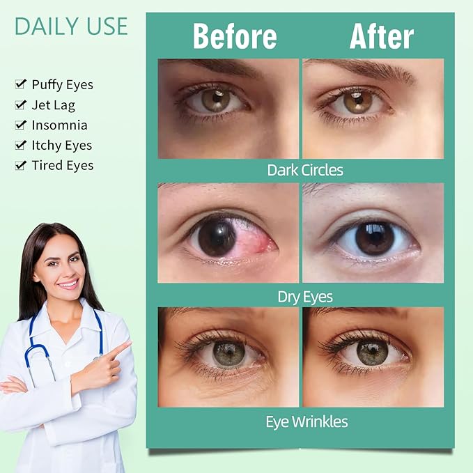 Serfeymi 16 packs steam eye