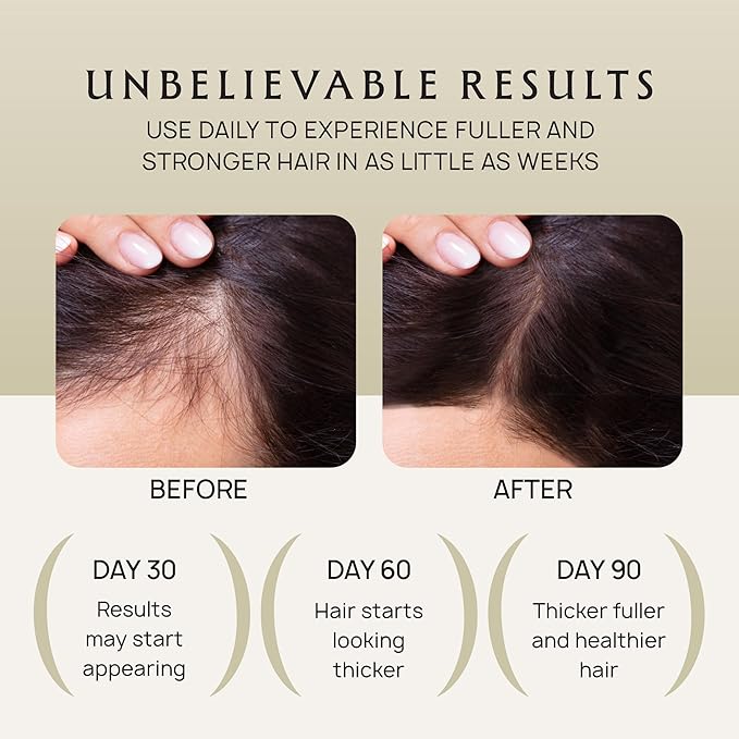 Hair Growth Oil Spray - 100% Pure Ingredients For Non Greasy, Thicker & Stronger Hair - Organic Batana, Castor, Biotin, Saw Palmetto, and Rosemary Oil for Men & Women Scalp - 4 FL OZ