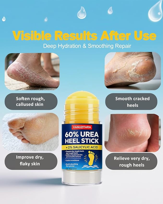 60% Urea Heel Stick l Maximum Strength Urea Stick for Rough, Dry Cracked Feet Hands Elbows, Callus Remover, Skin Softener Balm 1.41oz