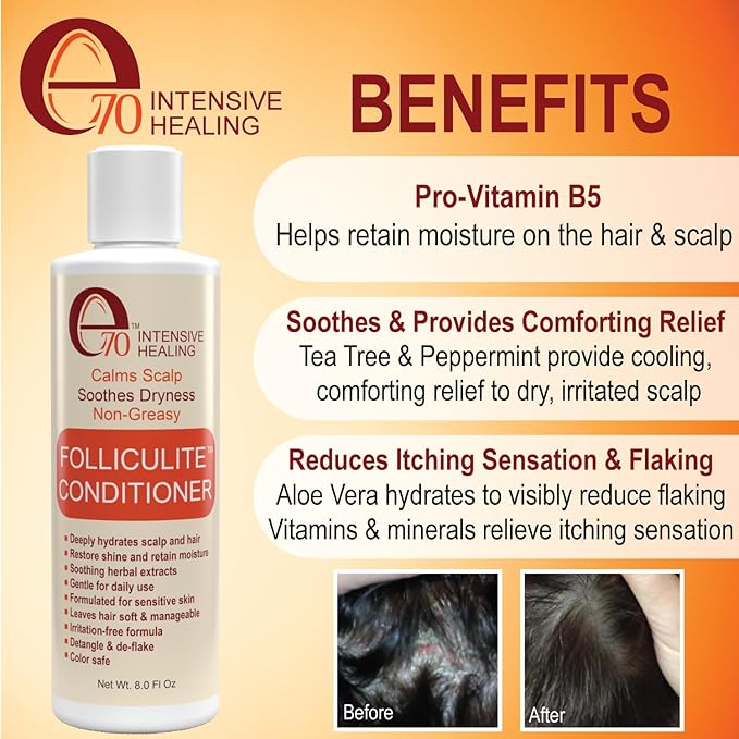 Folliculitis Treatment Hair Conditioner | Moisturize Sensitive Skin, Itchy, Dry Scalp & Damaged Hair Repair | Herbal Extracts for Soft, Shiny Hair | Gentle Color-Safe Detangling Solution