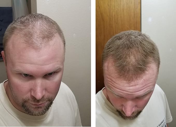 Quick Fix For Thinning Hair and Bald Spot. Get 10X Fuller Hair Instantly. All-Natural Hair Building Fiber For Hair. Trial Size (10-Day Supply). Light Brown