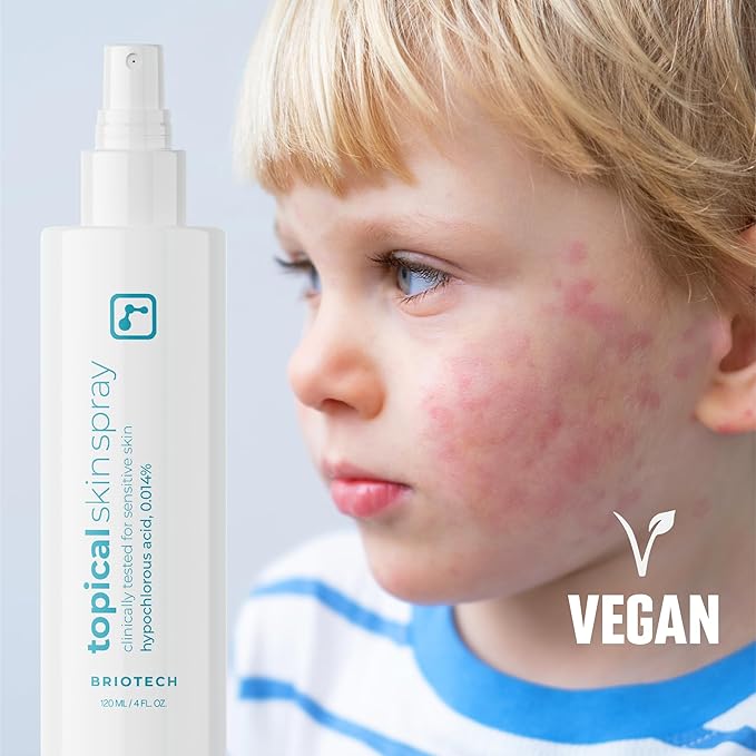 BRIOTECH Topical Skin Spray, Hypochlorous Acid for Sensitive Skin, HOCl Facial Mist, Full Body Support Against Irritation, Calm Redness, Soothe Foot & Scalp, 1 Gallon Refill (4 Pack)