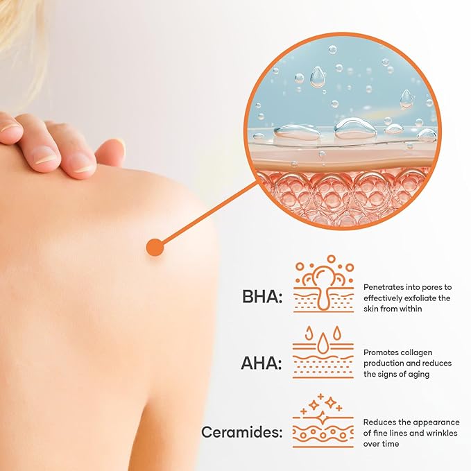 Salicylic Acid Body Wash - Skin Non-drying, Gentle Exfoliates Rough and Bumpy Skin, Body Acne Wash, BHA & AHA - Unscented Exfoliating Body Wash, Made in USA - (16 fl oz x 2)