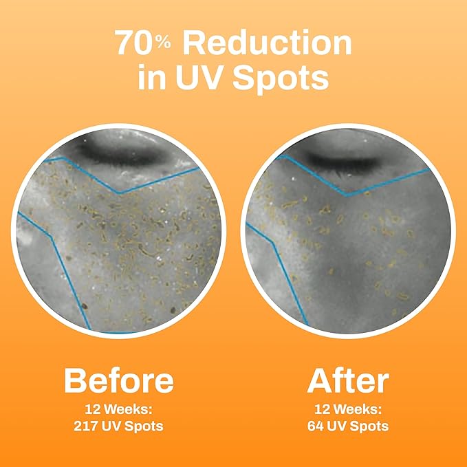 Photozyme DNA Youth Recovery Facial Serum | 1.7 Fl Oz