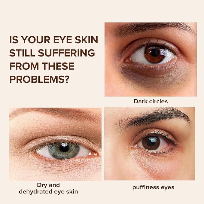 Caffeine Eye Cream for Dark Circles, Under Eye Treatment Eye Cream with Caffeine Anti Aging Wrinkles Lifting Firming Moisturizer Tightening Eye Cream 20ML