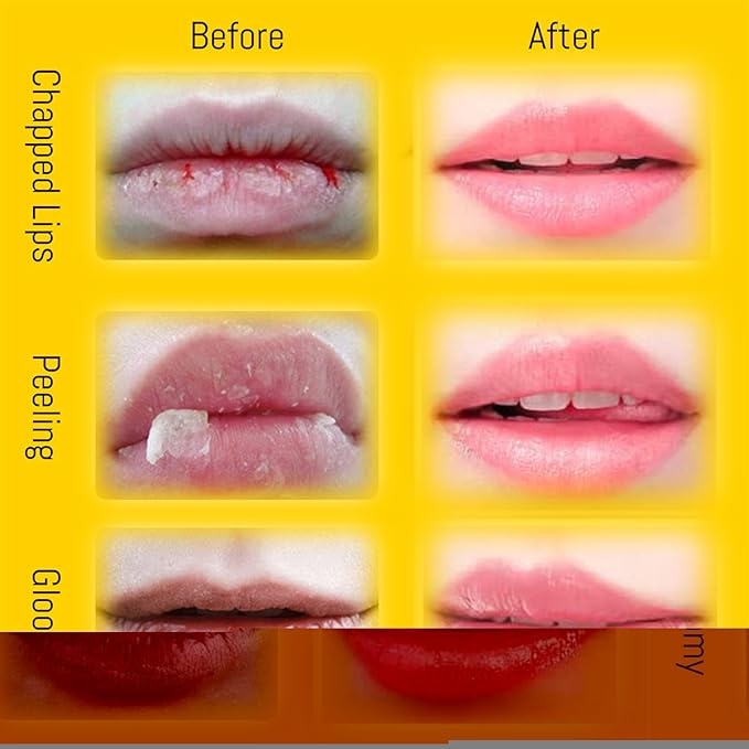 4PCS Lip Balm Honey Pot, Honey Sleeping