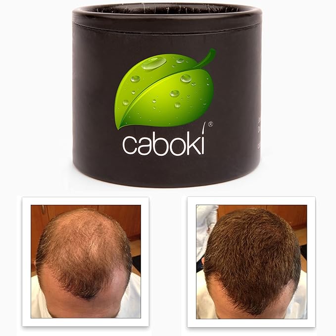 Thinning Hair Solution - All-Natural, Plant-Based Fibers For Fuller, Thicker Appearance. Instantly Covers Bald Spots. Auburn (red/ginger hair). Trial Size, 10-Day Supply